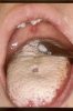 chlamydia_1-200x300.jpg