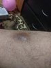 IMG_20180323_193714.jpg