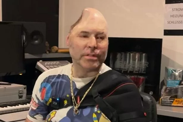 Нико Бреннер Нико Бреннер